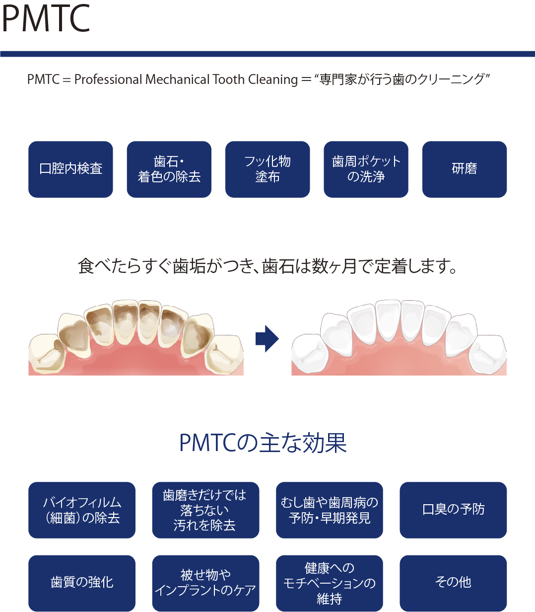 PMTC